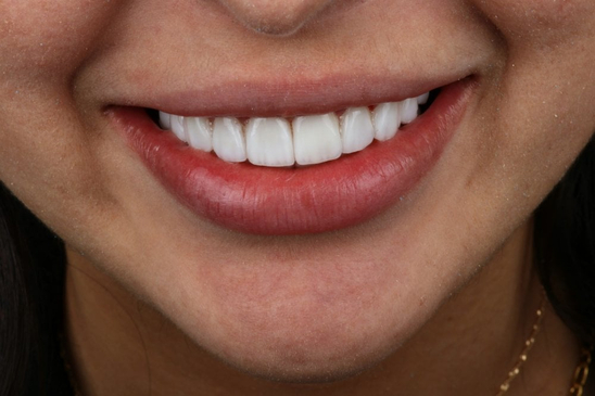 Slider image (3) Bright Way Dental Clinic